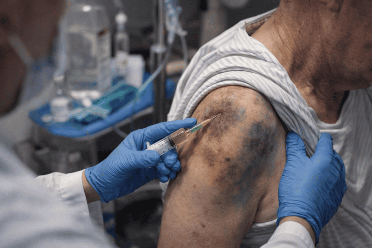 Beteg karján látható zúzódások és sérülések, miközben orvos injekciót ad.